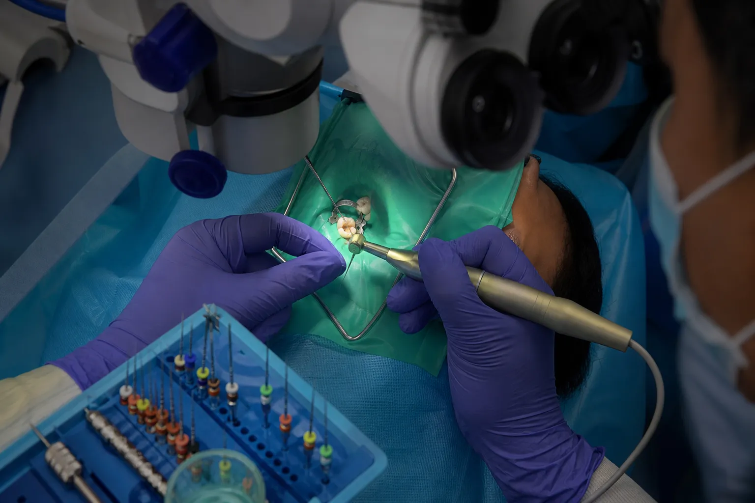 Root Canal / Rawatan Akar